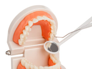 shirley pulpotomy treatment