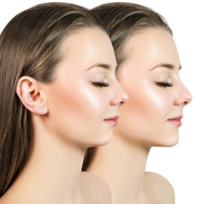 shirley corrective jaw surgery