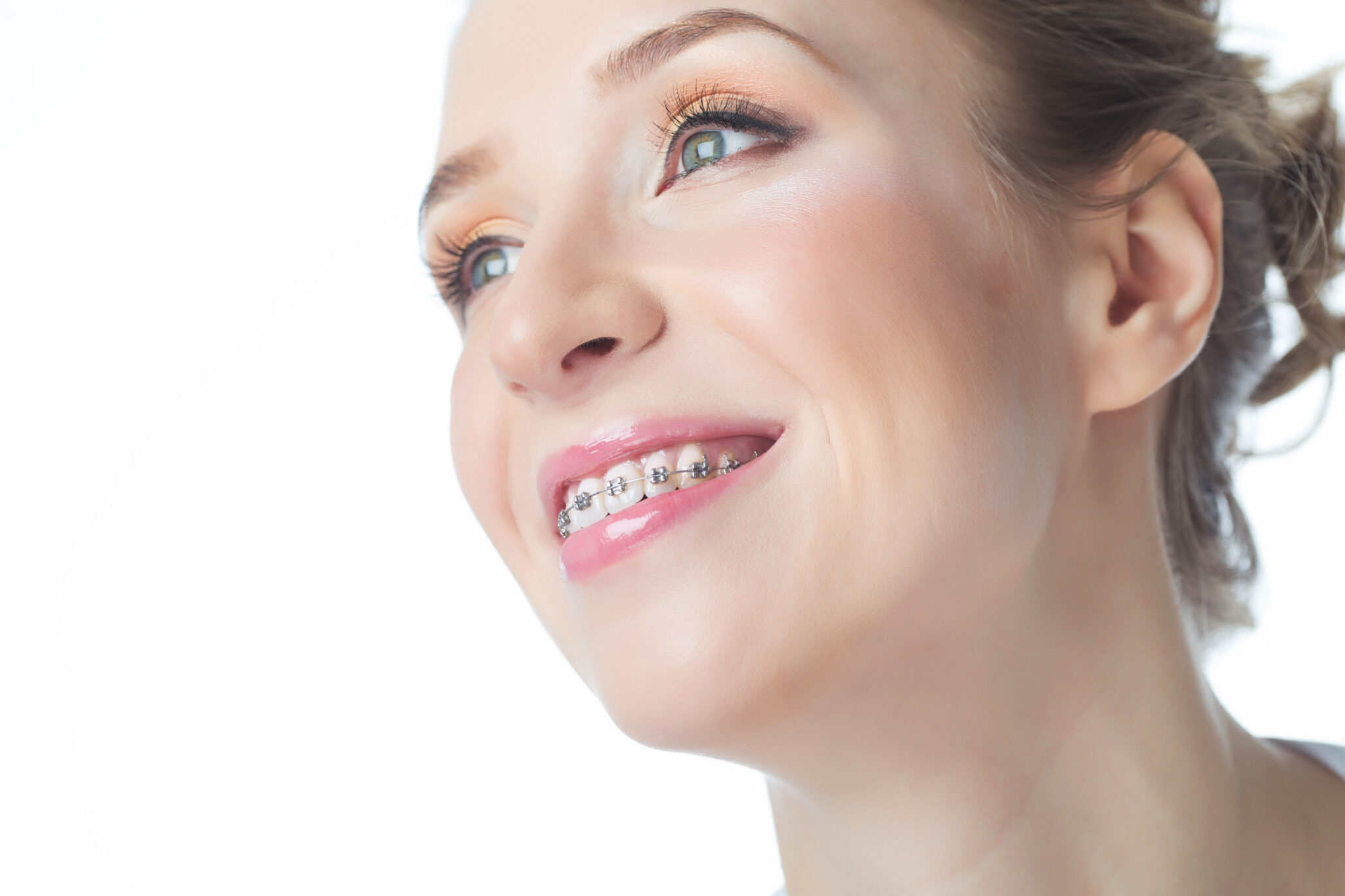 The Strength Of Traditional Braces Shirley, NY