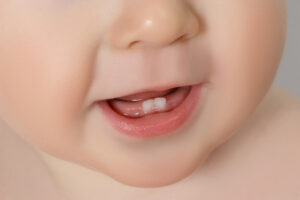 Shirley, NY, dentist offers pediatric and orthodontic services