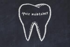 shirley space maintainer