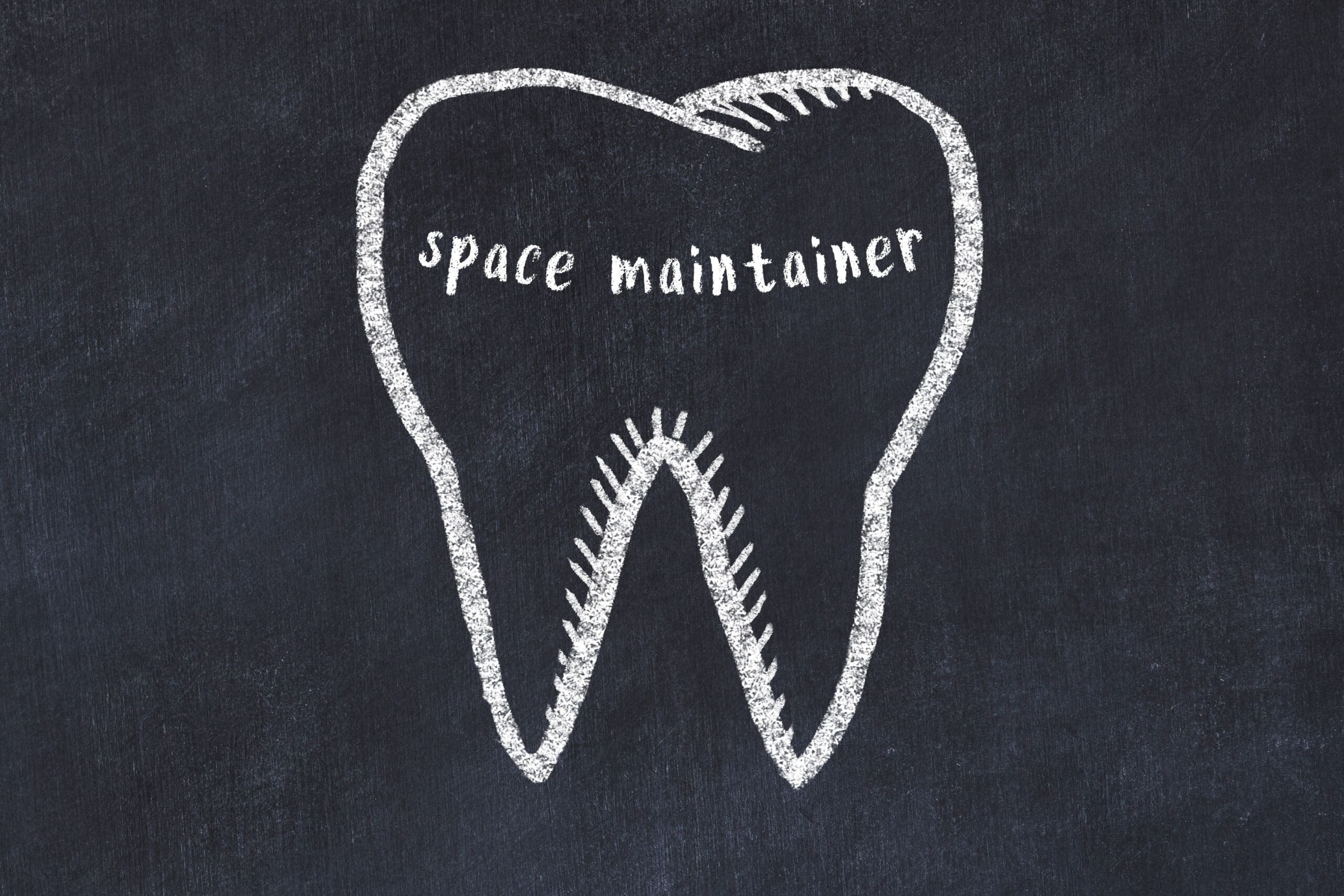shirley space maintainer